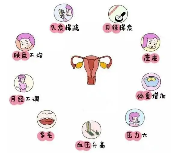 10个女人就有1个患多囊！被它缠上不要怕，艾灸帮你调“多囊”！